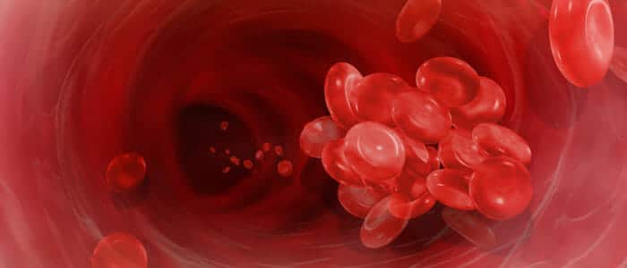 Venous Thrombolembolism Blood Clot